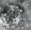 Hepatitis B virus